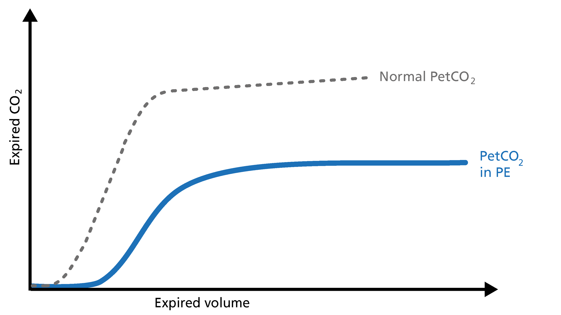 Basics of volumetric capnography - Part 3: Clinical relevance ...