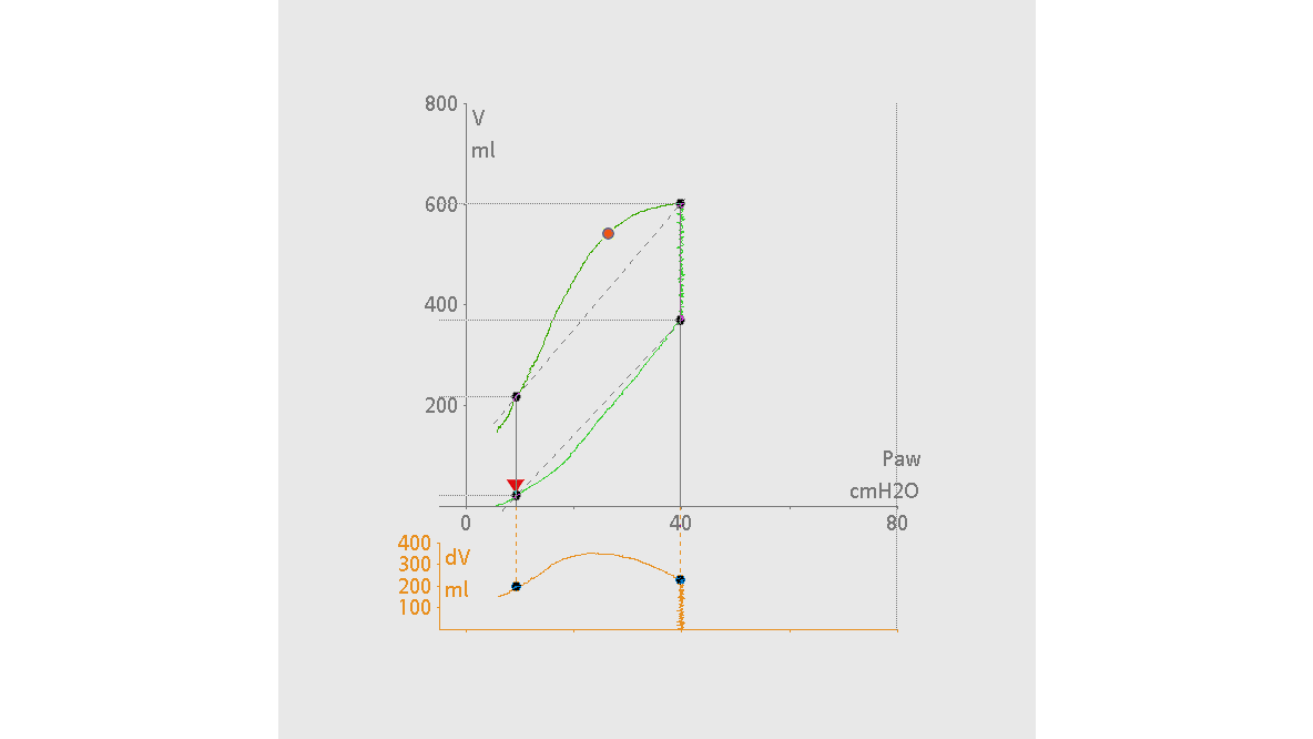 Pressure and volume curves with the P/V Tool