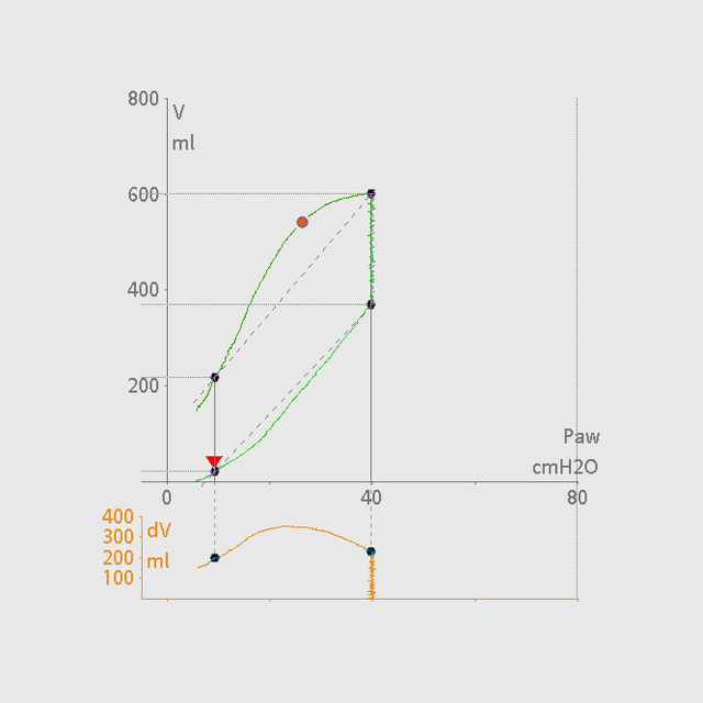 Courbes de pression et de volume avec la fonction P/V Tool