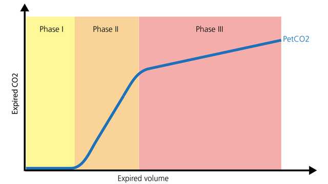 Schéma représentant trois phases