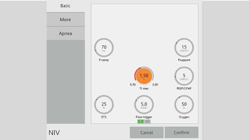 Basic settings window showing Ti max set to 1.5