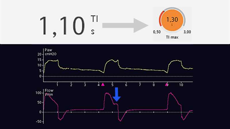 Display showing longer plateau on inspiratory flow