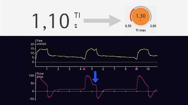 Display showing longer plateau on inspiratory flow