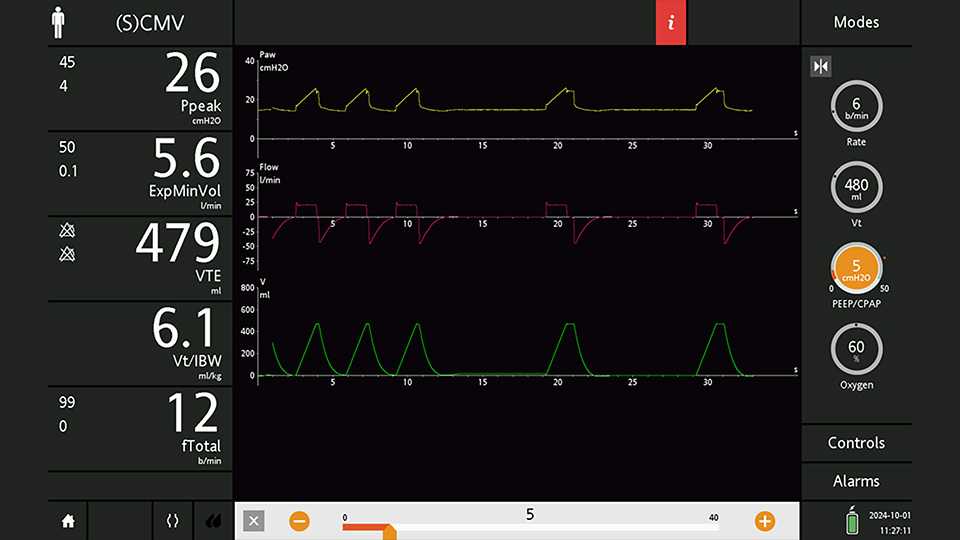 Screenshot showing PEEP decreased to 5 cmH2O