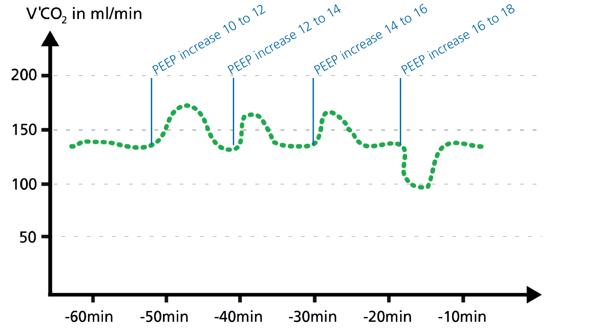 Basics Of Volumetric Capnography - Part 4: Clinical Applications Of ...