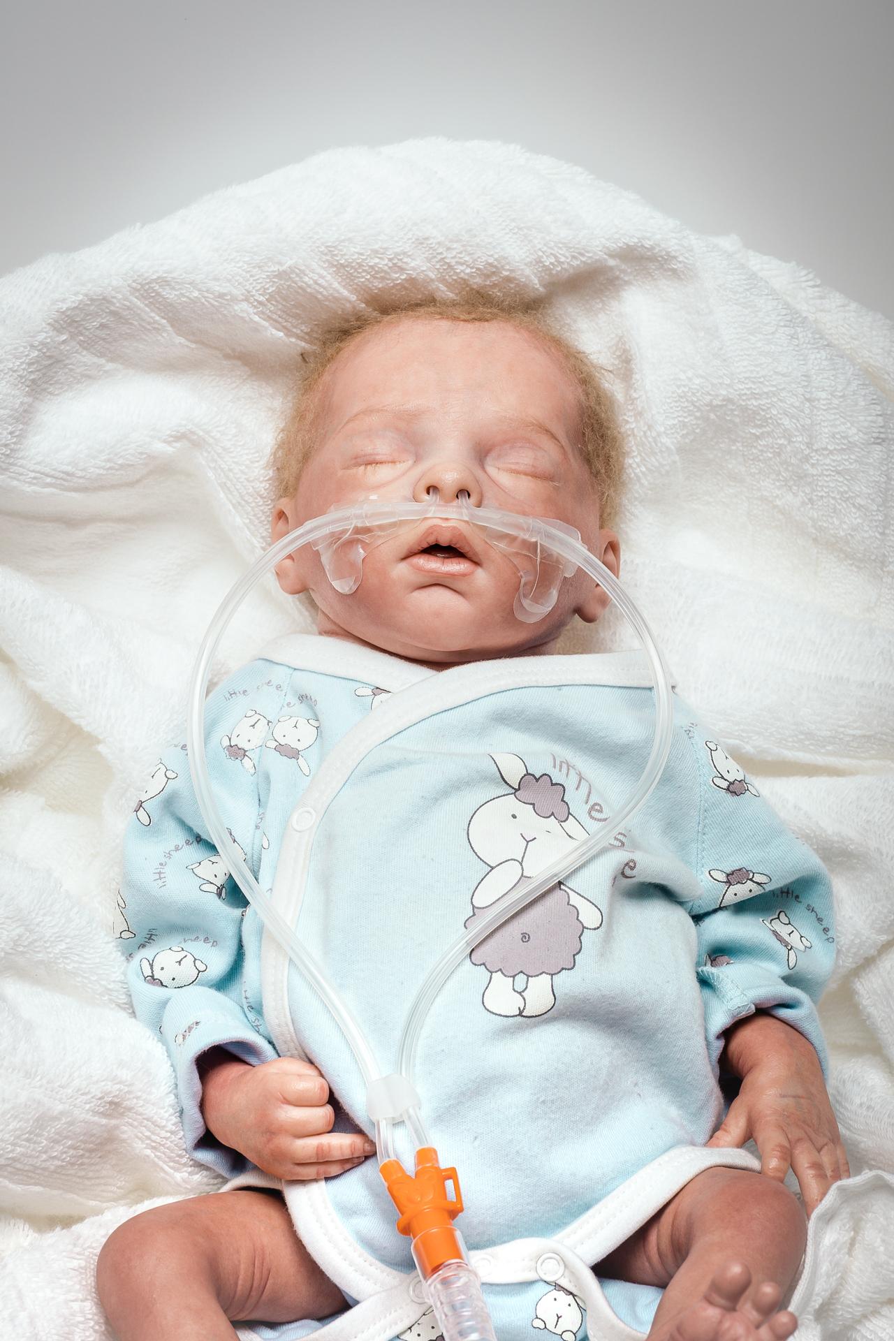 Sleeping baby whit Nuflow® nasal cannula
