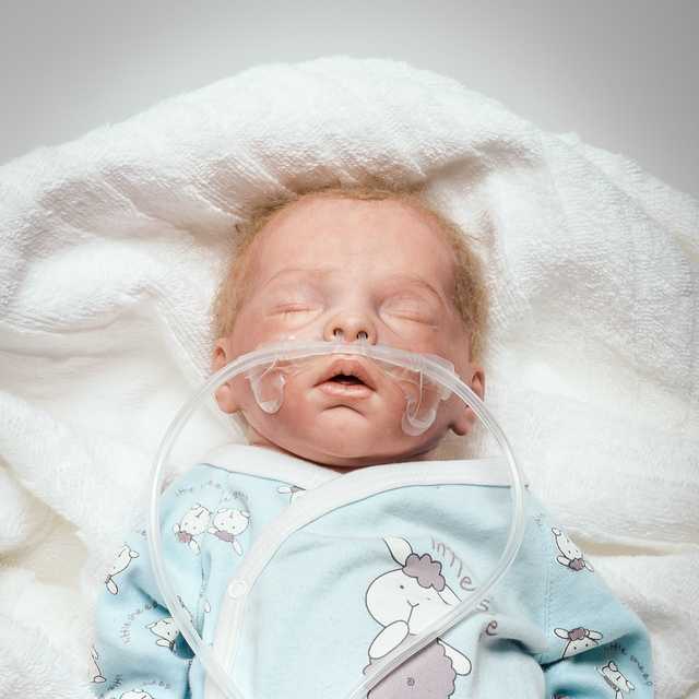 Sleeping baby whit Nuflow® nasal cannula