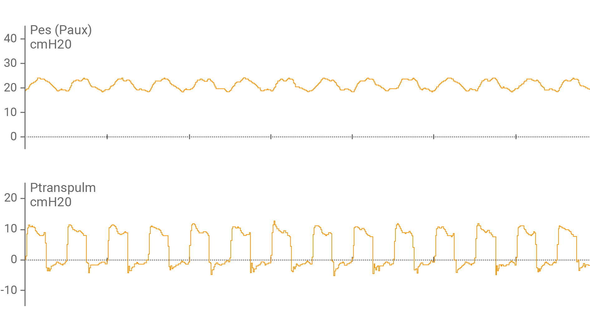 Ventilator display showing esophageal pressure (Pes), and transpulmonary pressures (Ptranspulm) as a waveform.