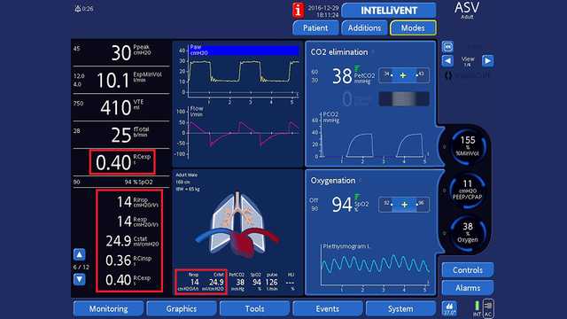 Screenshot showing dynamic lung, monitoring parameters, and oxygenation and ventilation windows