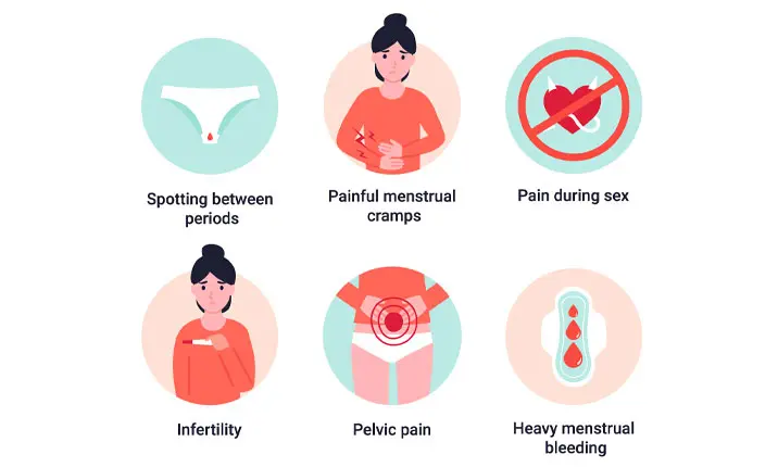 Chronic pelvic pain and heavy menstrual bleeding are common symptoms of  endometriosis. People with this condition may also have a hard time…