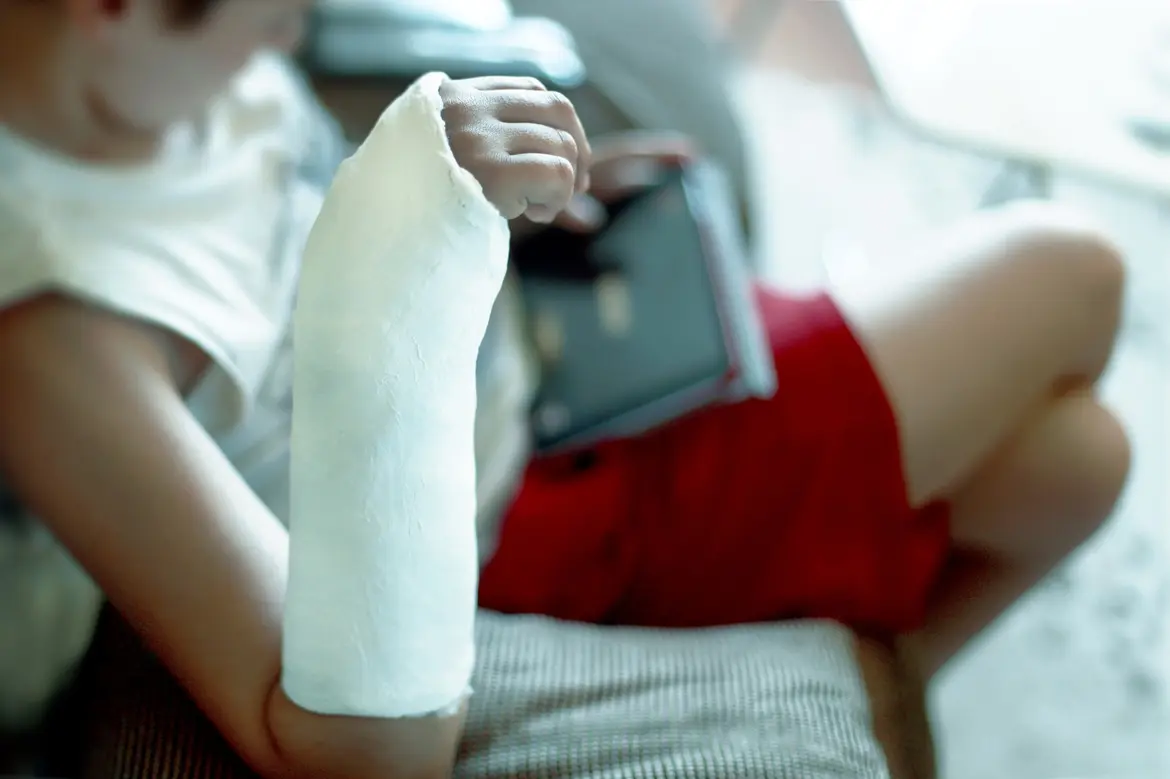 Understanding Broken Bones in Children