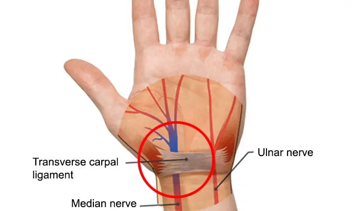 Anatomy Of The Median Nerve - Everything You Need To Know - Dr