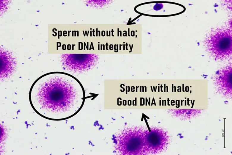 DNA 精子测试