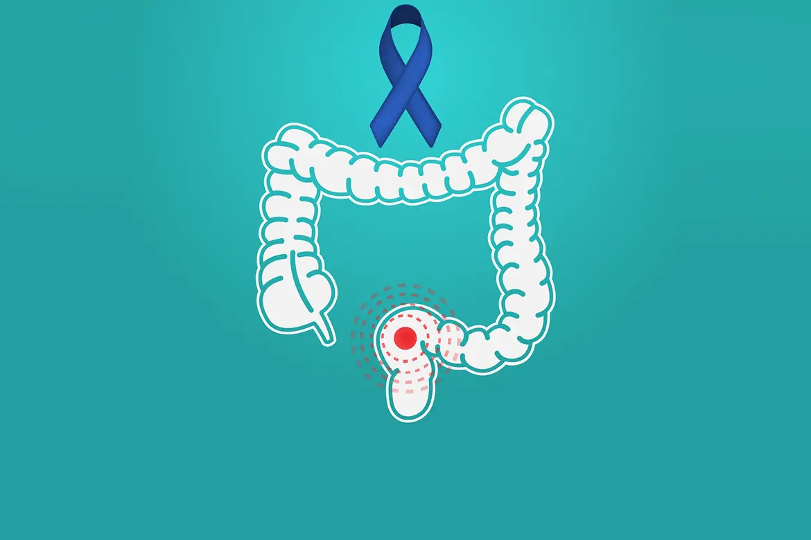 Why is colorectal cancer so common in Singapore?