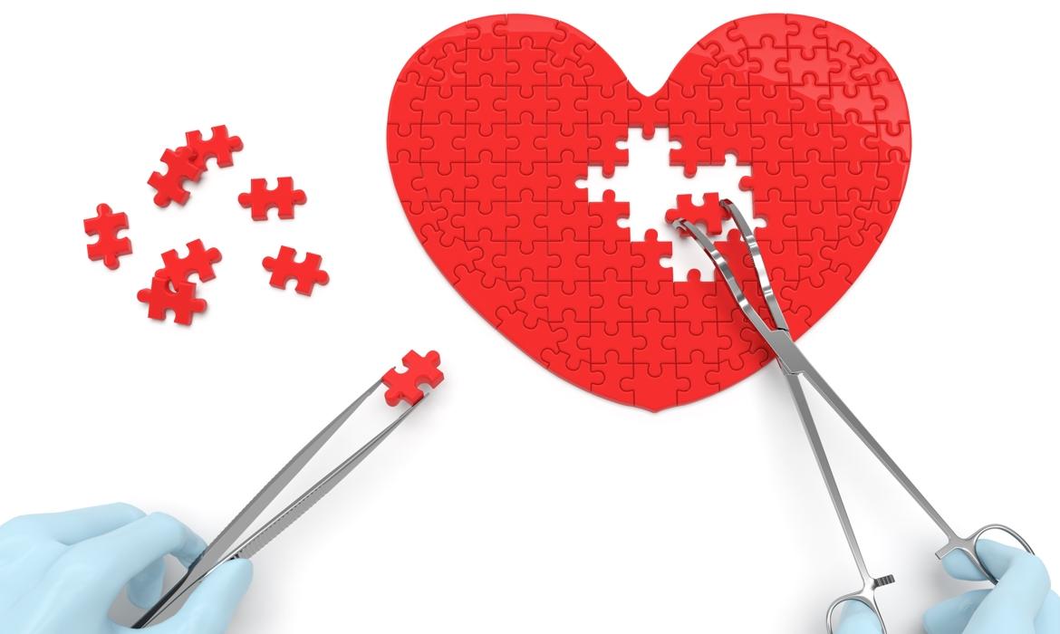 heart-surgery-main-d