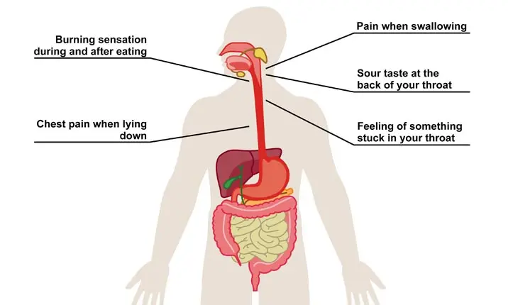 stomach acid pain