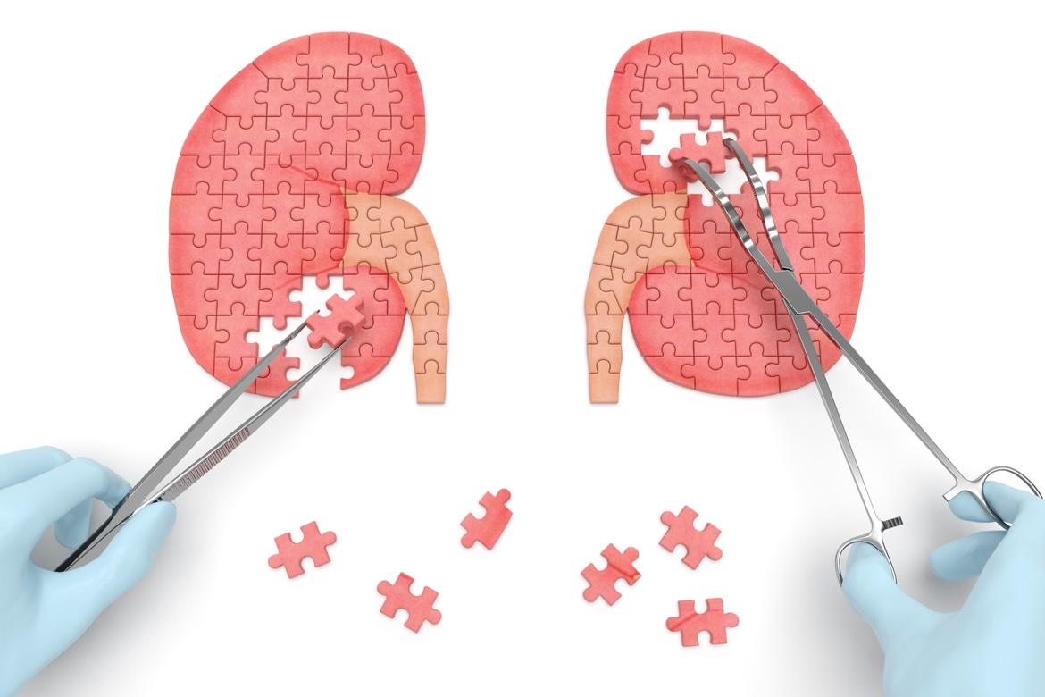 Renal Medicine (Kidneys) - Related Conditions