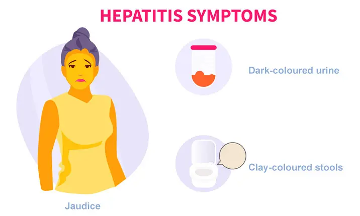 Gejala hepatitis