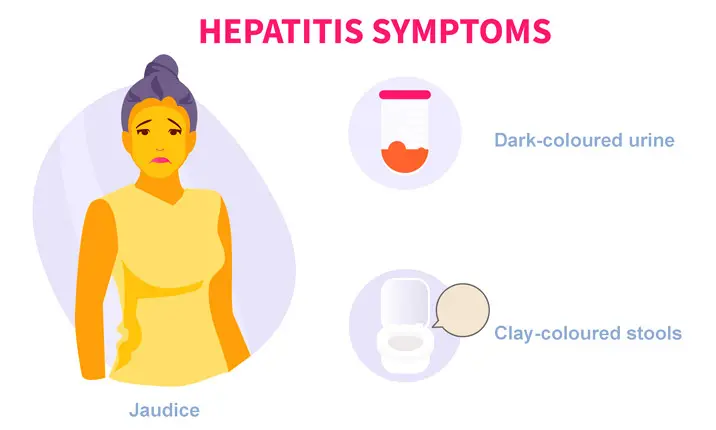 hepatitis symptoms