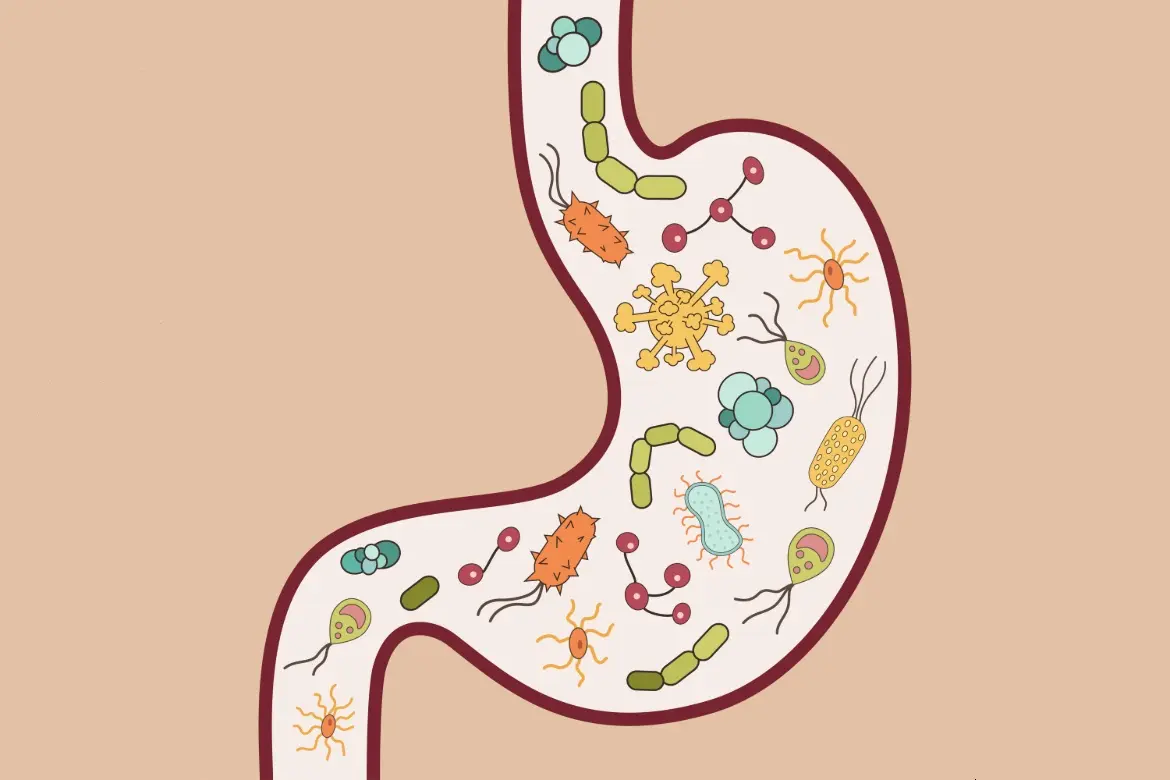 What is Ulcerative Colitis?  The IBS & Gut Health Clinic