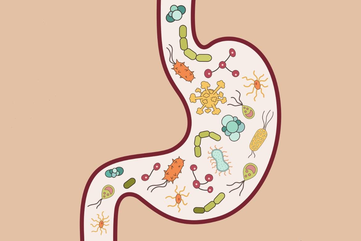 什么是 IBD？克罗恩病 vs 溃疡性结肠炎