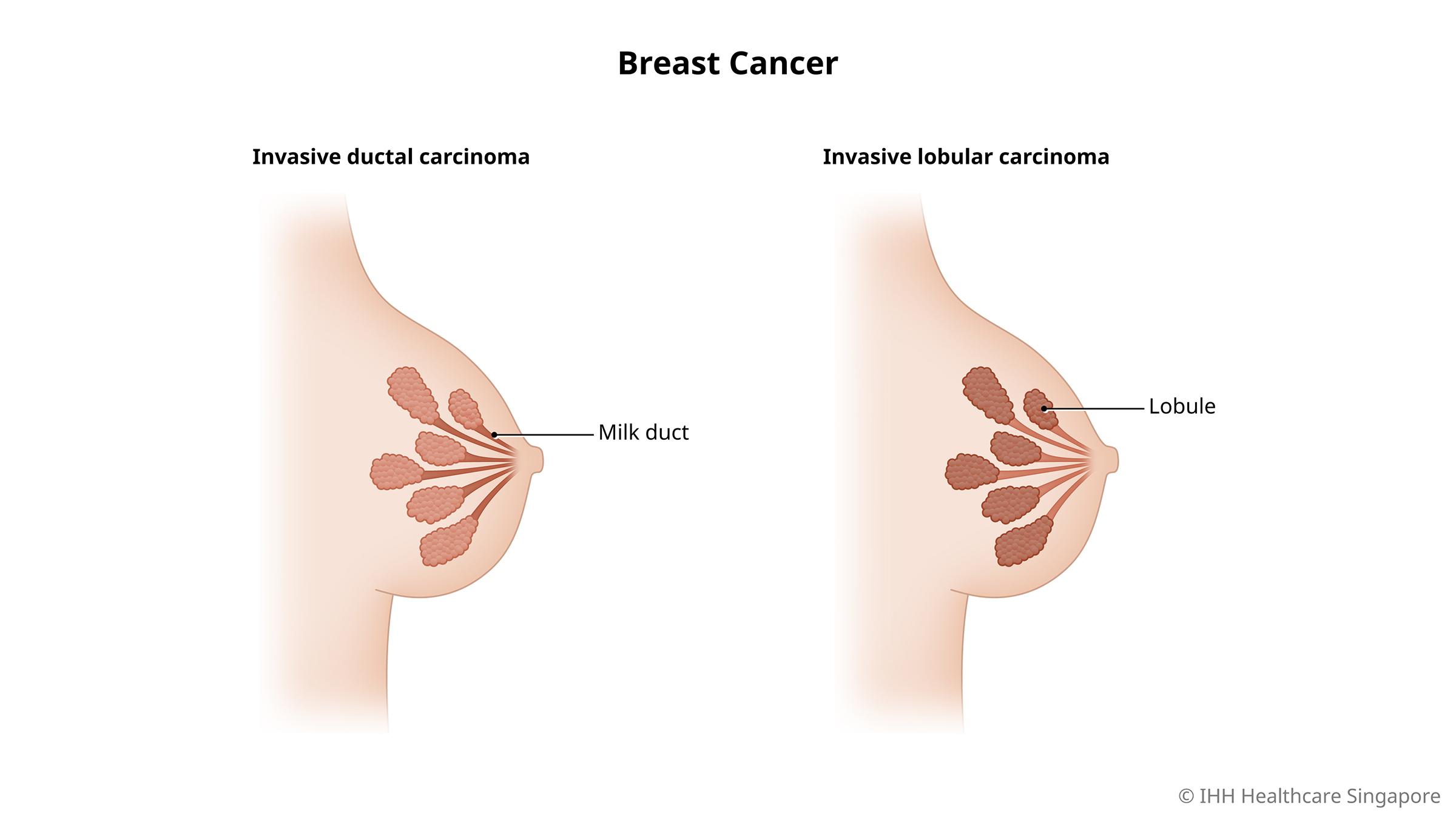 Nipple Symptoms - Are My Nipples Normal