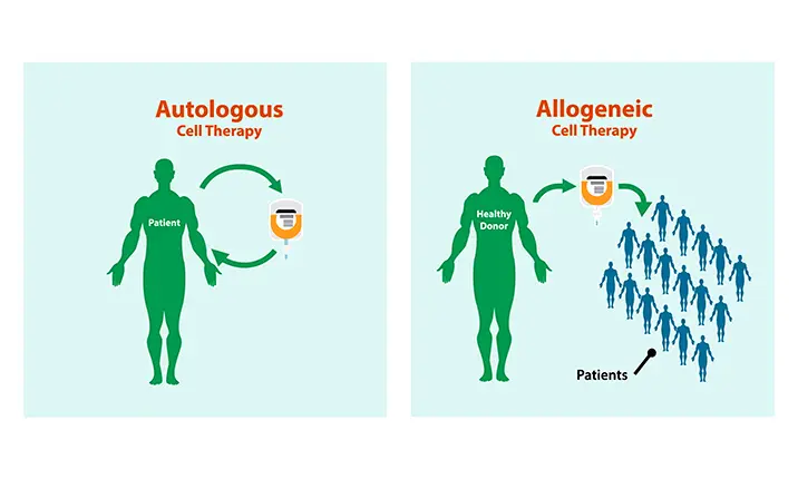 Autologous or allogeneic stem cell transplant