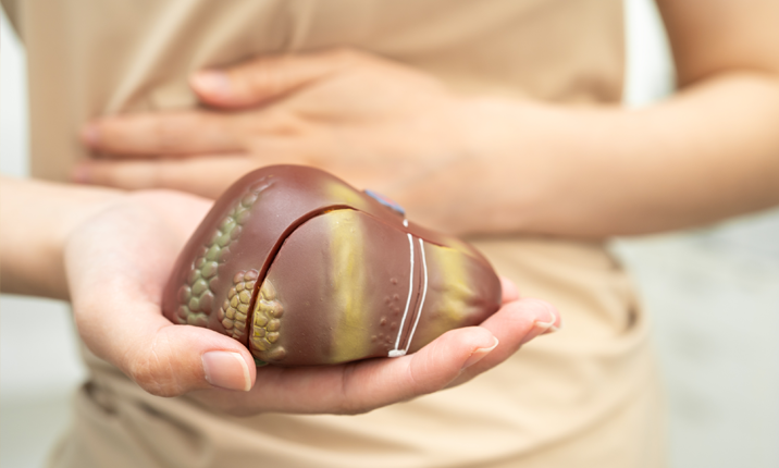 Mdm Chua-liver-cancer-image2