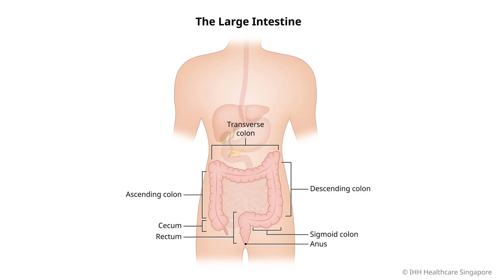 Illustration of large intestine, cecum, ascending colon, transverse colon, descending colon, sigmoid colon, rectum, and anus.