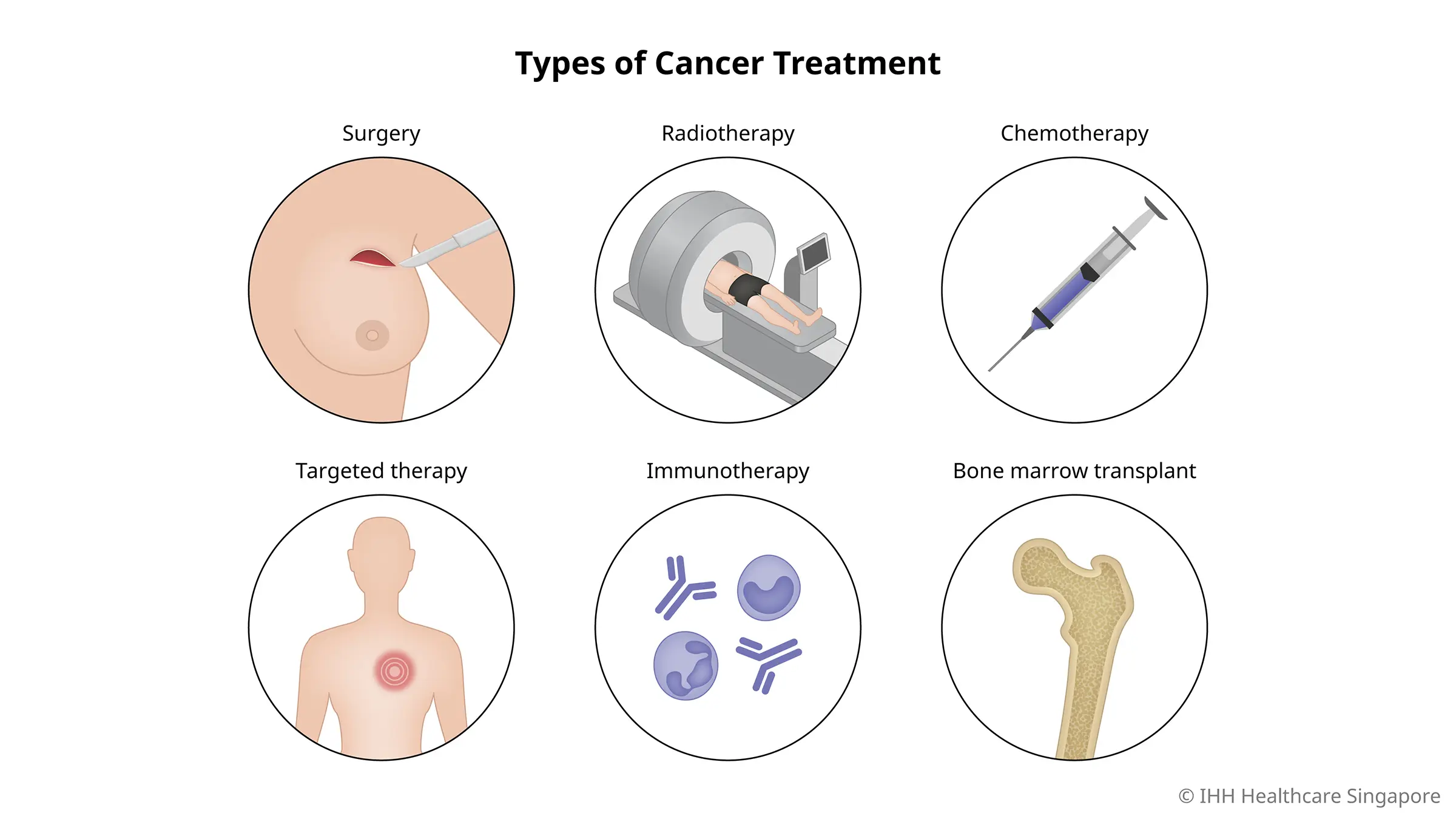 Treatment of Cancer, Types of Cancer Treatment & Therapies