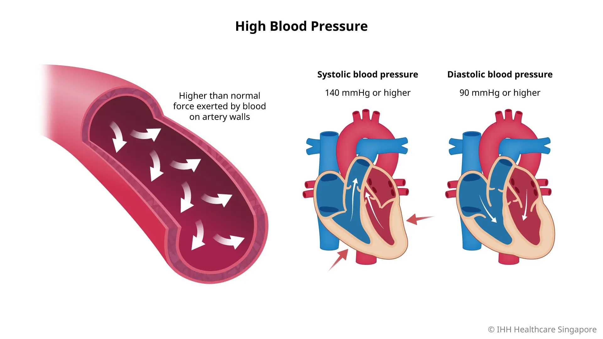 What is considered a high blood pressure