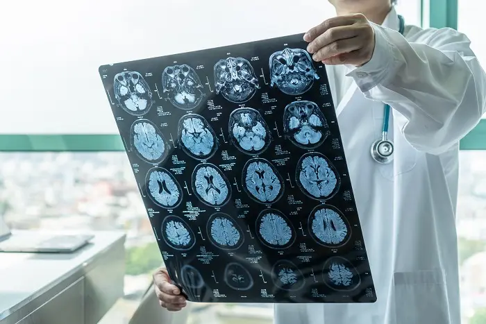 A male neurosurgeon studying a patient’s report after a brain scan