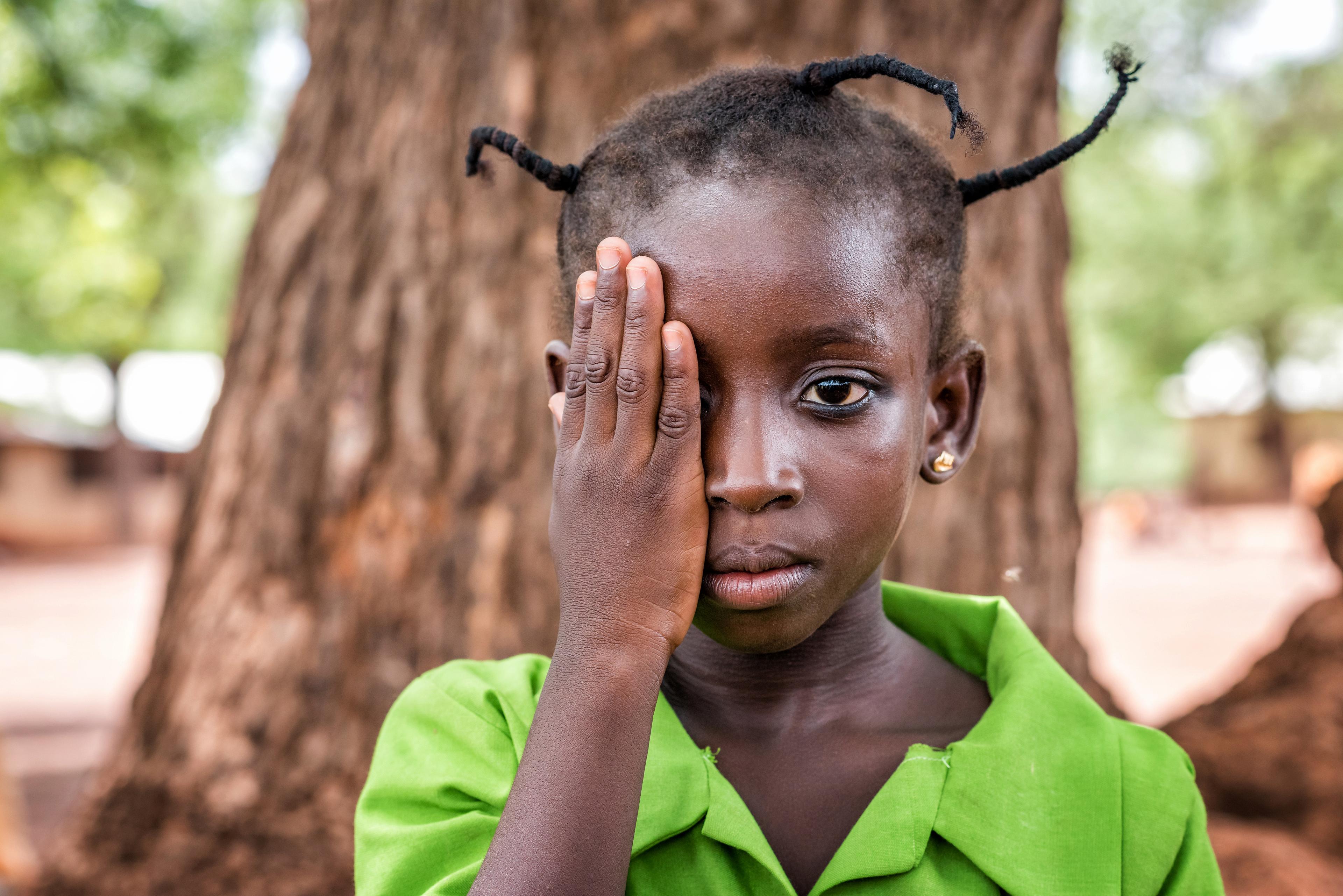 Asana, six ans, passe un test oculaire dans une école près de Tamale. Elle se tient devant un tronc d'arbre imposant.